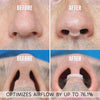 Intake Breathing Nasal Strip